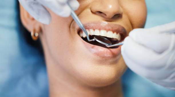 Best Emergency Denture Repair in Glasgow, MO